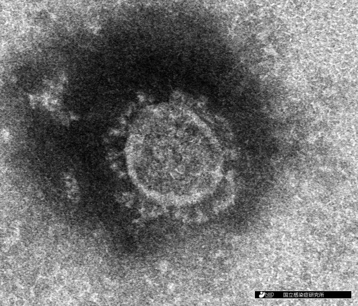 新型コロナウイルスの電子顕微鏡写真像